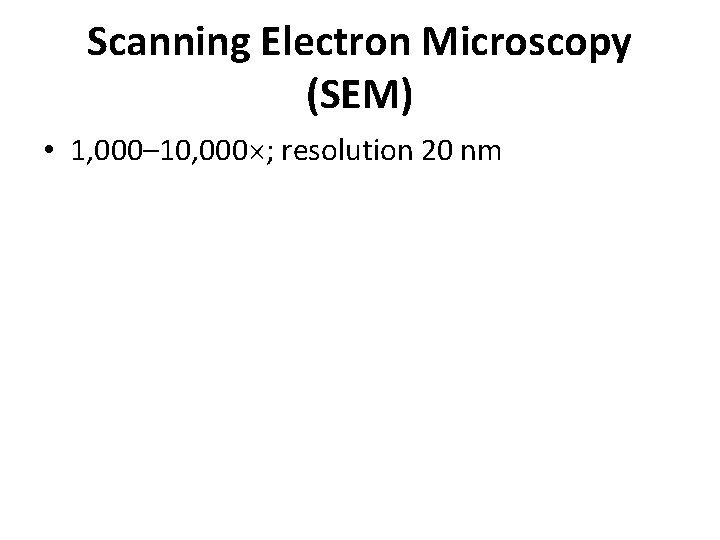 Scanning Electron Microscopy (SEM) • 1, 000– 10, 000 ; resolution 20 nm 