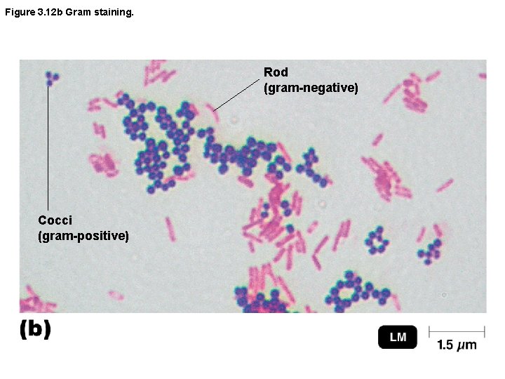 Figure 3. 12 b Gram staining. Rod (gram-negative) Cocci (gram-positive) 