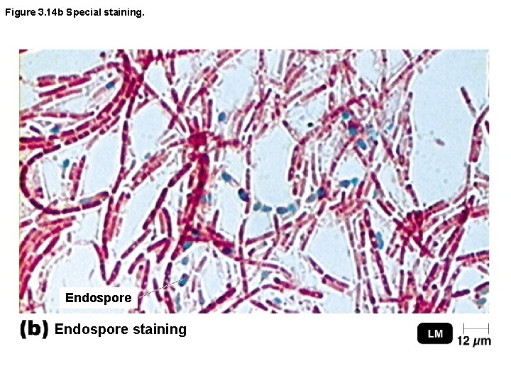 Figure 3. 14 b Special staining. Endospore staining 