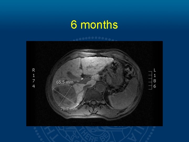 6 months 