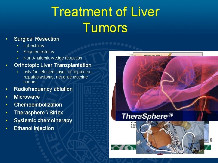 Treatment of Liver Tumors • Surgical Resection • • Orthotopic Liver Transplantation • •