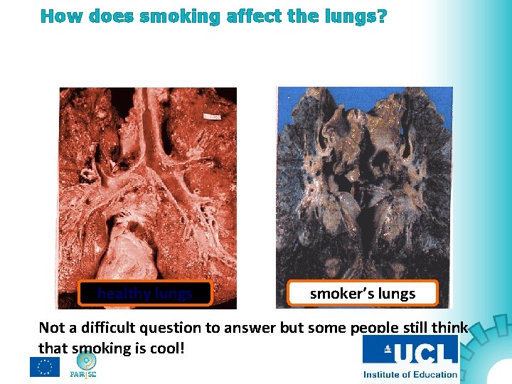 How does smoking affect the lungs? healthy lungs smoker’s lungs Not a difficult question