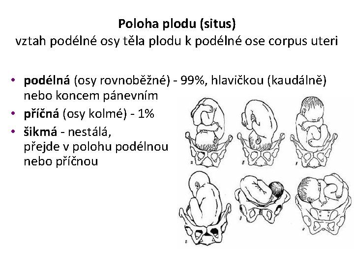 Poloha plodu (situs) vztah podélné osy těla plodu k podélné ose corpus uteri •