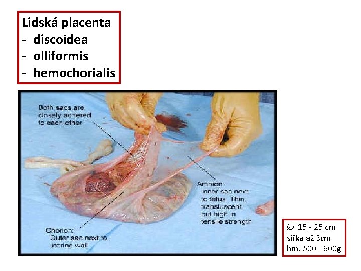 Lidská placenta - discoidea - olliformis - hemochorialis Æ 15 - 25 cm šířka