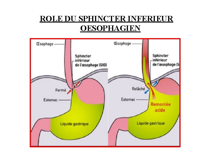 ROLE DU SPHINCTER INFERIEUR OESOPHAGIEN 