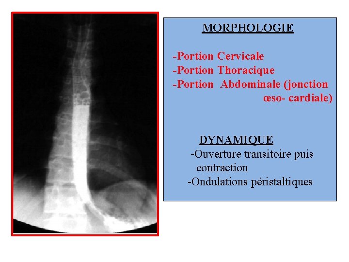 MORPHOLOGIE -Portion Cervicale -Portion Thoracique -Portion Abdominale (jonction œso- cardiale) DYNAMIQUE -Ouverture transitoire puis