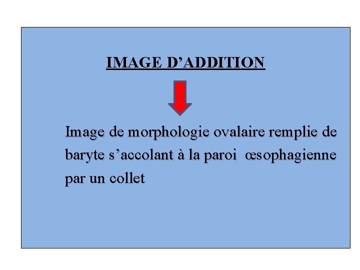 IMAGE D’ADDITION Image de morphologie ovalaire remplie de baryte s’accolant à la paroi œsophagienne