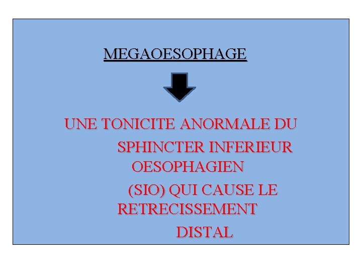 MEGAOESOPHAGE UNE TONICITE ANORMALE DU SPHINCTER INFERIEUR OESOPHAGIEN (SIO) QUI CAUSE LE RETRECISSEMENT DISTAL