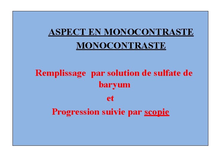 ASPECT EN MONOCONTRASTE Remplissage par solution de sulfate de baryum et Progression suivie par