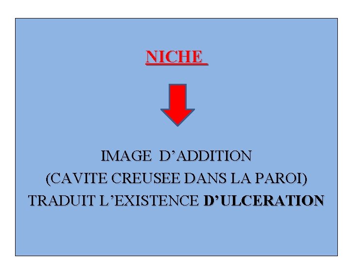 NICHE IMAGE D’ADDITION (CAVITE CREUSEE DANS LA PAROI) TRADUIT L’EXISTENCE D’ULCERATION 