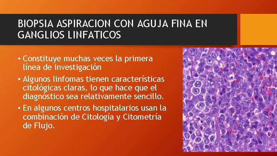 BIOPSIA ASPIRACION CON AGUJA FINA EN GANGLIOS LINFATICOS • Constituye muchas veces la primera