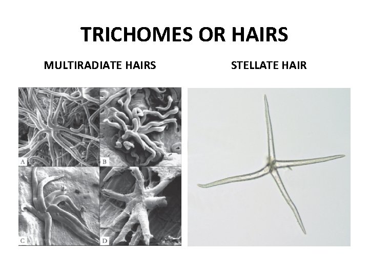 TRICHOMES OR HAIRS MULTIRADIATE HAIRS STELLATE HAIR 