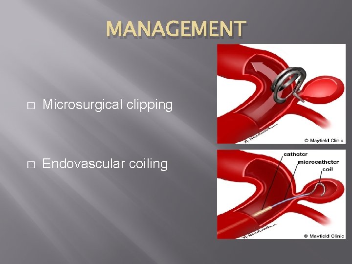 MANAGEMENT � Microsurgical clipping � Endovascular coiling 