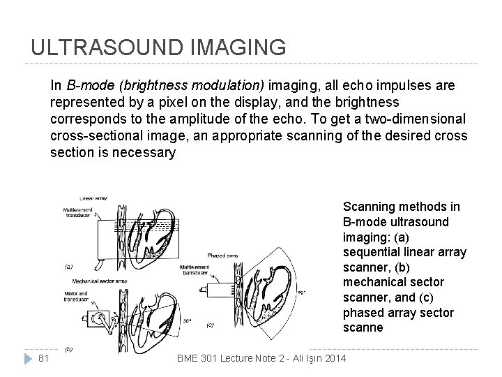 ULTRASOUND IMAGING In B-mode (brightness modulation) imaging, all echo impulses are represented by a