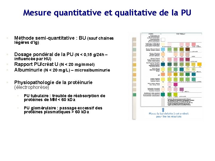 Mesure quantitative et qualitative de la PU § Méthode semi-quantitative : BU (sauf chaînes