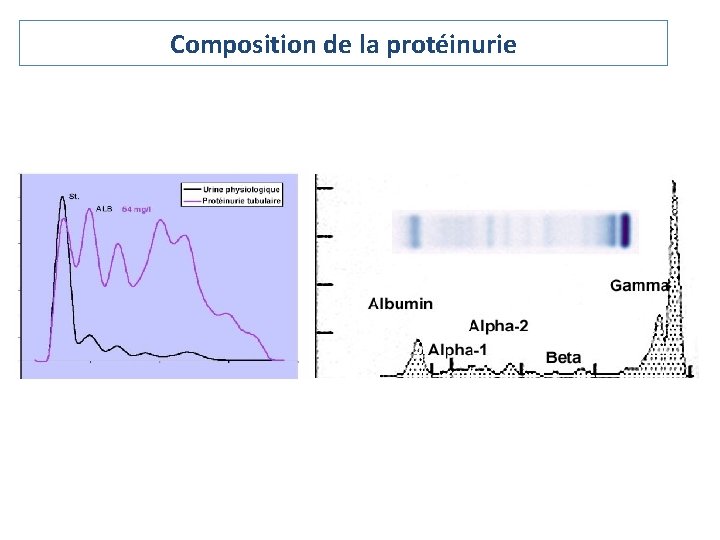 Composition de la protéinurie 