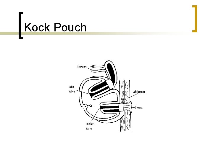 Kock Pouch 