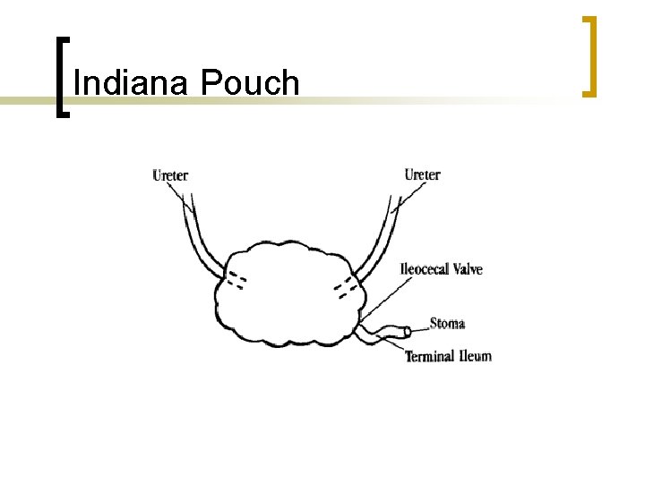 Indiana Pouch 