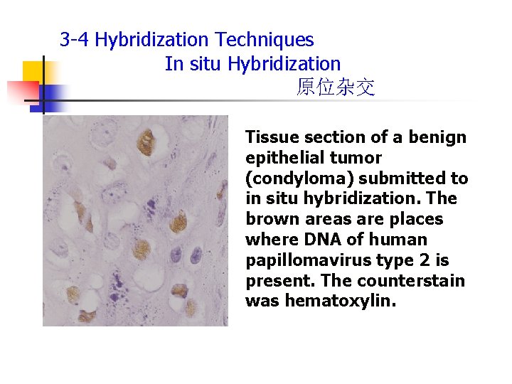 3 -4 Hybridization Techniques In situ Hybridization 原位杂交 Tissue section of a benign epithelial