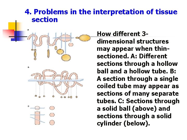 4. Problems in the interpretation of tissue section How different 3 dimensional structures may