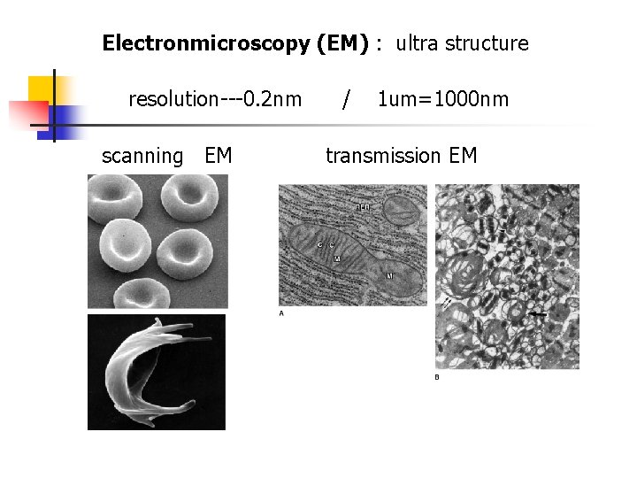 Electronmicroscopy (EM) : ultra structure resolution---0. 2 nm scanning EM / 1 um=1000 nm