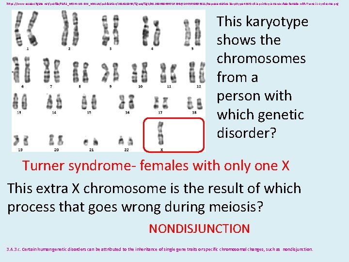 https: //www. researchgate. net/profile/Tahir_MOHI-UD-DIN_MALLA/publication/281810039/figure/fig 2/AS: 280680664715298@1443930893811/Representative-karyotype-46 XO-of-a-primary-amenorrhea-female-with-Turner's-syndrome. png This karyotype shows the chromosomes from