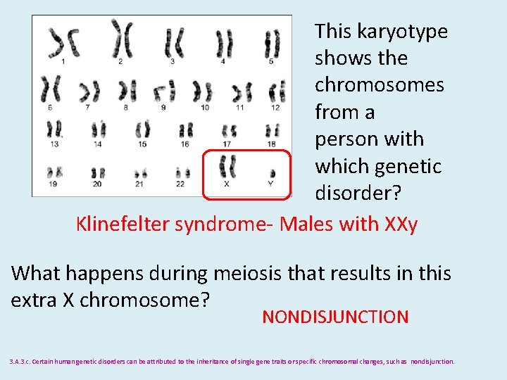 This karyotype shows the chromosomes from a person with which genetic disorder? Klinefelter syndrome-