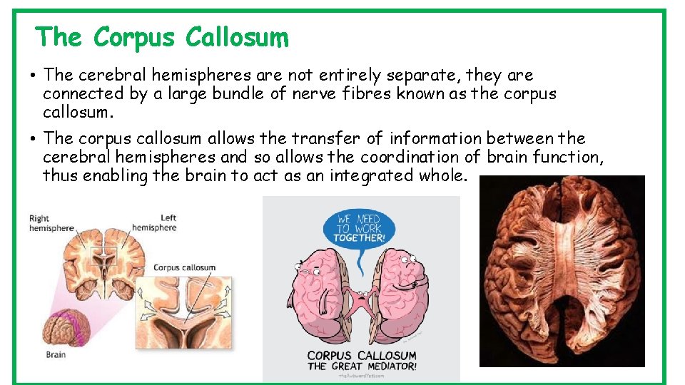 The Corpus Callosum • The cerebral hemispheres are not entirely separate, they are connected