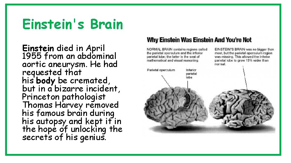 Einstein's Brain Einstein died in April 1955 from an abdominal aortic aneurysm. He had