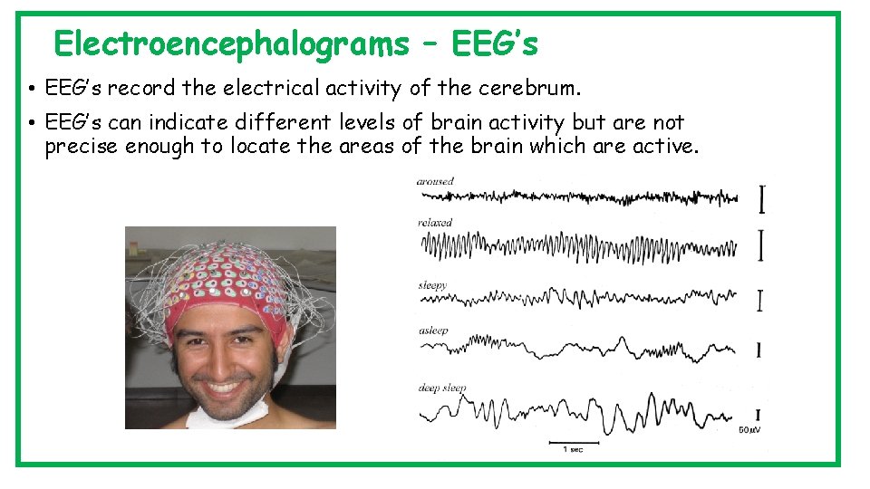 Electroencephalograms – EEG’s • EEG’s record the electrical activity of the cerebrum. • EEG’s