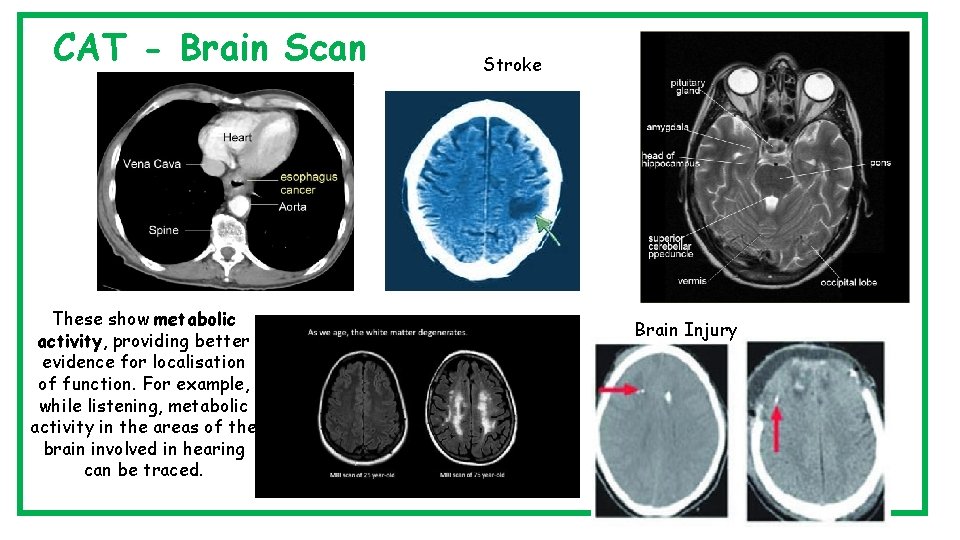 CAT - Brain Scan These show metabolic activity, providing better evidence for localisation of