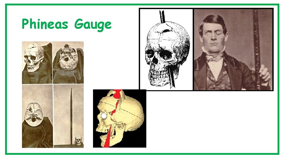 Phineas Gauge 
