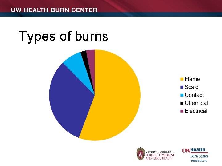 Types of burns 
