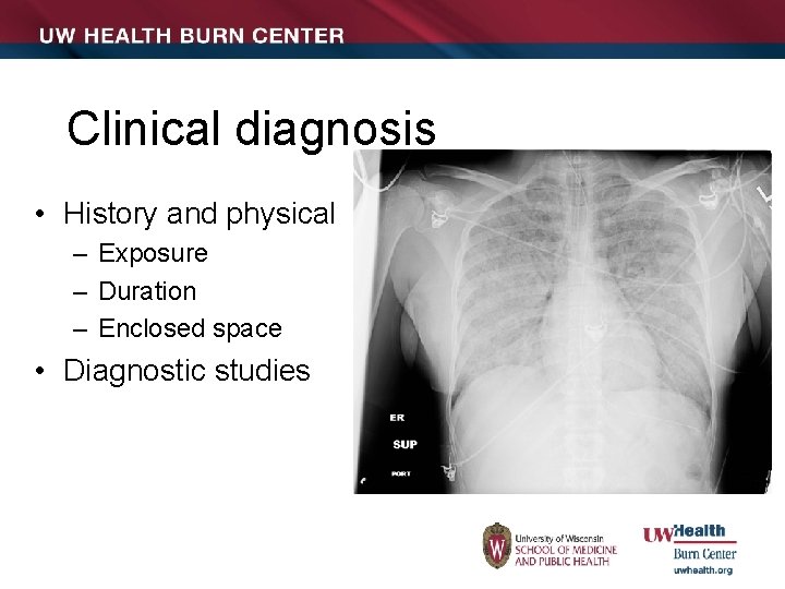 Clinical diagnosis • History and physical – Exposure – Duration – Enclosed space •