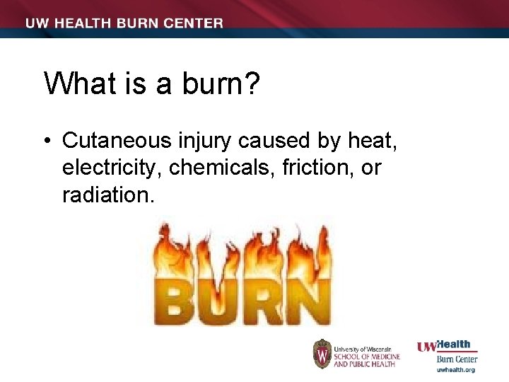 What is a burn? • Cutaneous injury caused by heat, electricity, chemicals, friction, or
