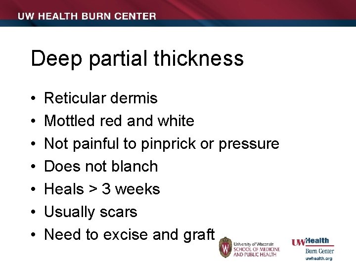 Deep partial thickness • • Reticular dermis Mottled red and white Not painful to