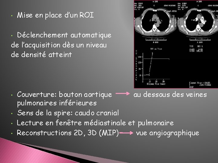 • Mise en place d’un ROI Déclenchement automatique de l’acquisition dès un niveau • Mise en place d’un ROI Déclenchement automatique de l’acquisition dès un niveau