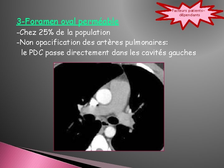 3 -Foramen oval perméable Facteurs patientsdépendants -Chez 25% de la population -Non opacification des