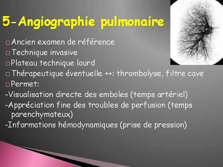 5 -Angiographie pulmonaire � Ancien examen de référence � Technique invasive � Plateau technique 5 -Angiographie pulmonaire � Ancien examen de référence � Technique invasive � Plateau technique