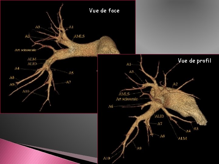Vue de face Vue de profil Vue de face Vue de profil