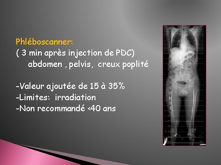 Phléboscanner: ( 3 min après injection de PDC) abdomen , pelvis, creux poplité -Valeur