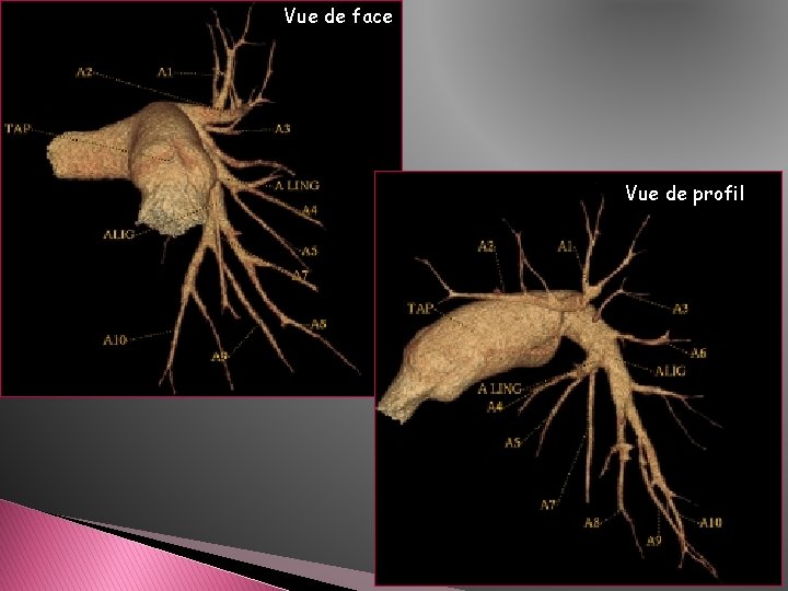 Vue de face Vue de profil Vue de face Vue de profil