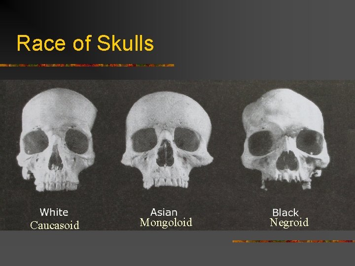 Race of Skulls Caucasoid Mongoloid Negroid 