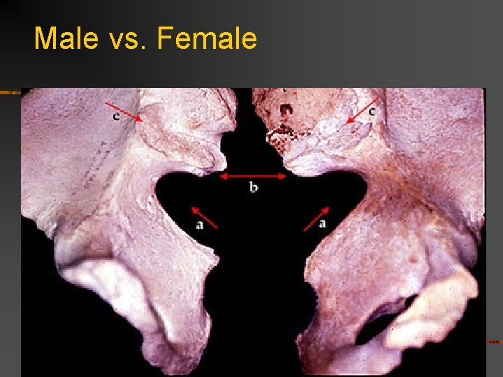 Male vs. Female 