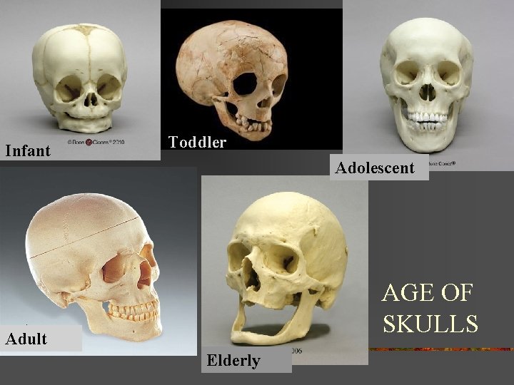 AGE Infant Toddler Adolescent AGE OF SKULLS Adult Elderly 