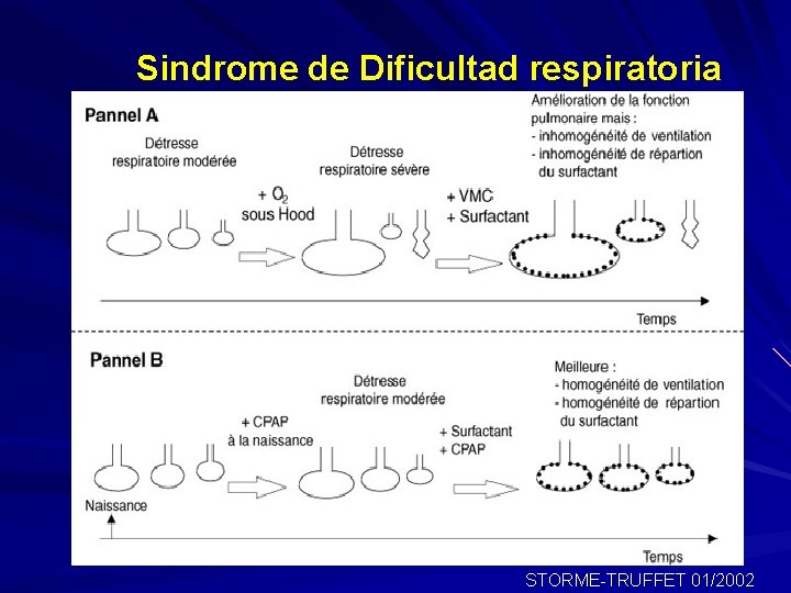 Sindrome de Dificultad respiratoria STORME-TRUFFET 01/2002 