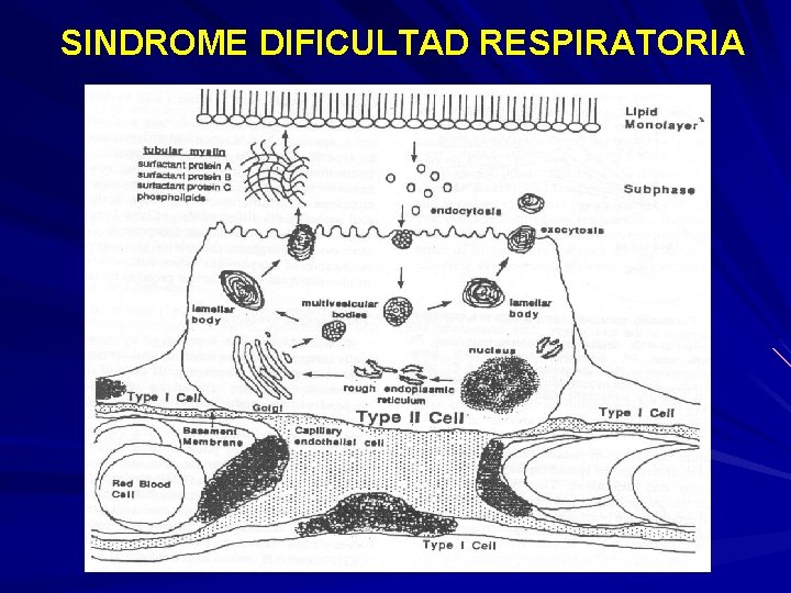 SINDROME DIFICULTAD RESPIRATORIA 
