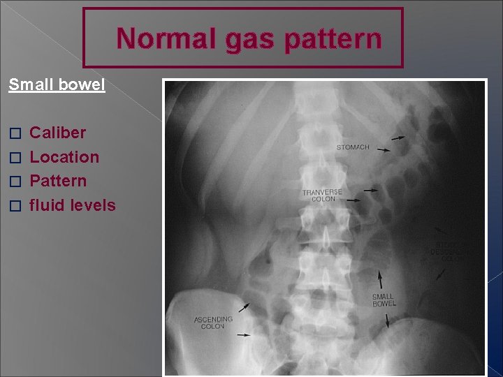 Normal gas pattern Small bowel Caliber � Location � Pattern � fluid levels �