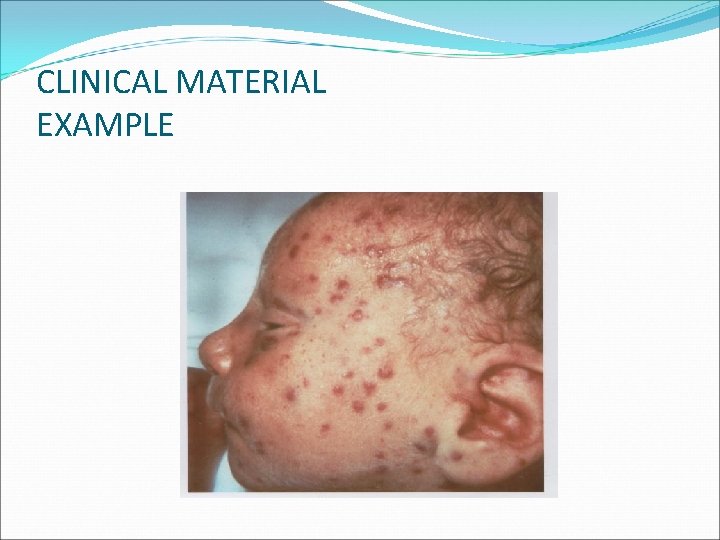 CLINICAL MATERIAL EXAMPLE 