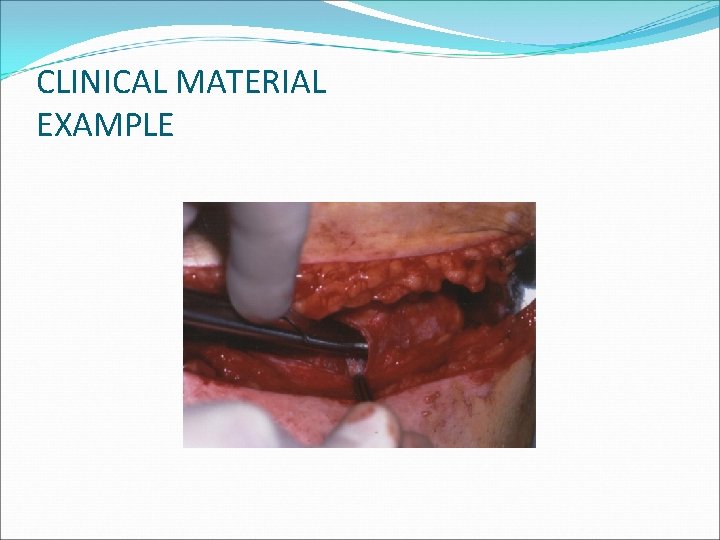 CLINICAL MATERIAL EXAMPLE 